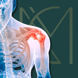 /reabilitacao-apos-protese-de-ombro/